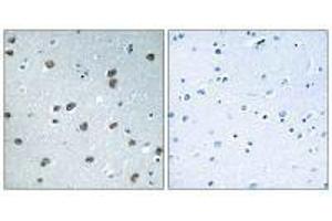 Immunohistochemistry analysis of paraffin-embedded human brain tissue using KLHL29 antibody.