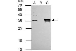 IP Image TFIIE beta antibody immunoprecipitates TFIIE beta protein in IP experiments. (GTF2E2 Antikörper)