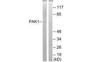 Western blot analysis of extracts from 3T3 cells, treated with UV (15 mins), using PAK1 (Ab-204) antibody. (PAK1 Antikörper  (Ser204))