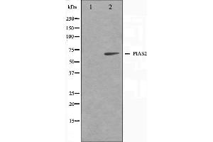 Western blot analysis on COS7 cell lysate using PIAS2 Antibody,The lane on the left is treated with the antigen-specific peptide. (PIAS2 Antikörper)