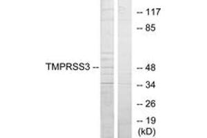 Western blot analysis of extracts from HuvEc cells, using TMPRSS3 Antibody.