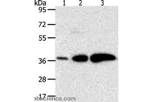 Western blot analysis of Human liver cancer and breast infiltrative duct tissue, human fetal brain tissue, using AKR1C1 Polyclonal Antibody at dilution of 1:500 (AKR1C1 Antikörper)