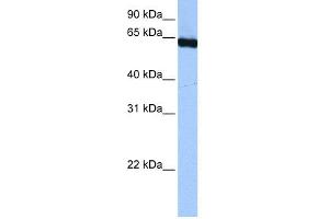 WB Suggested Anti-PUF60  Antibody Titration: 0. (PUF60 Antikörper  (C-Term))