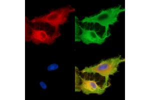 ABIN7096281 and ABIN7100343 staining  cells by IF/ICC.