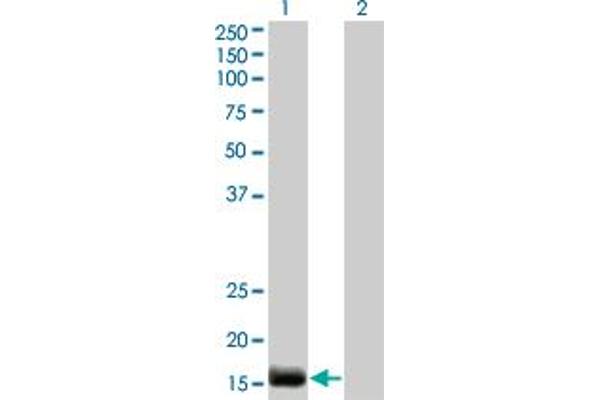 Endothelin 2 Antikörper  (AA 1-178)