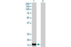 Western Blot analysis of EDN2 expression in transfected 293T cell line by EDN2 monoclonal antibody (M01), clone 3B4-1C5.