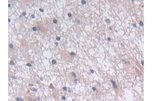 Immunohistochemistry (IHC) image for anti-Growth Hormone Releasing Hormone (GHRH) (AA 19-108) antibody (ABIN7429781)