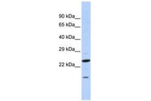 Image no. 1 for anti-Insulin Induced Gene 2 (INSIG2) (N-Term) antibody (ABIN6740653) (INSIG2 Antikörper  (N-Term))