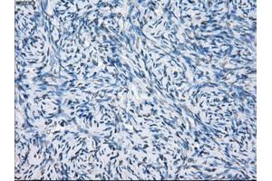Immunohistochemical staining of paraffin-embedded colon tissue using anti-FCGR2A mouse monoclonal antibody. (FCGR2A Antikörper)