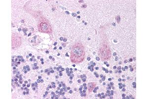 Immunohistochemistry (IHC) image for anti-Cholinergic Receptor, Nicotinic, alpha 3 (Neuronal) (CHRNA3) (AA 26-75) antibody (ABIN6736366)