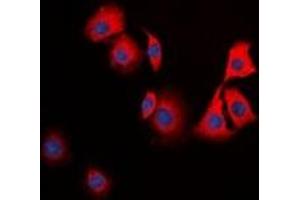 Immunofluorescent analysis of TPH1 staining in HuvEc cells. (Tryptophan Hydroxylase 1 Antikörper)
