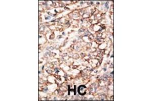 Immunohistochemistry (Paraffin-embedded Sections) (IHC (p)) image for anti-Bone Morphogenetic Protein Receptor 1A (BMPR1A) (AA 166-196), (C-Term) antibody (ABIN1882067)