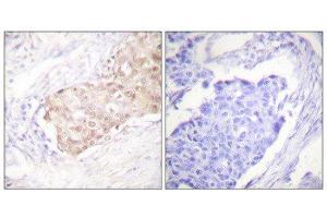Immunohistochemistry (IHC) image for anti-Ubiquitin Protein Ligase E3 Component N-Recognin 5 (UBR5) (N-Term) antibody (ABIN1848820) (UBR5 Antikörper  (N-Term))