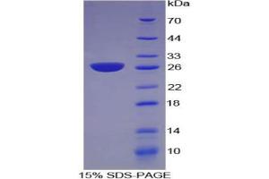 SDS-PAGE analysis of Mouse NNMT Protein. (NNMT Protein)
