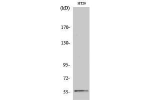 Western Blotting (WB) image for anti-Checkpoint Kinase 1 (CHEK1) (Ser249) antibody (ABIN3183902) (CHEK1 Antikörper  (Ser249))