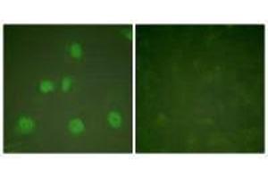 Immunofluorescence analysis of HeLa cells, treated with PMA (125 ng/mL, 30 mins), using Cullin 1 antibody. (Cullin 1 Antikörper)