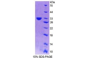 SDS-PAGE analysis of Mouse PLCd4 Protein. (PLCD4 Protein)