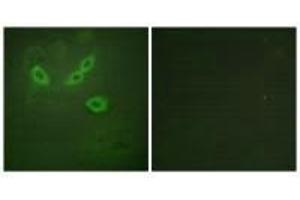Immunofluorescence analysis of HeLa cells, using TUSC5 antibody. (TUSC5 Antikörper)