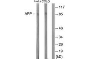 beta Amyloid Antikörper  (AA 711-760)