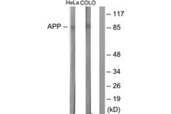 beta Amyloid Antikörper  (AA 711-760)