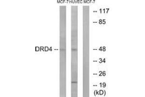 Western blot analysis of extracts from MCF-7/HuvEc cells, using DRD4 Antibody. (DRD4 Antikörper  (AA 355-404))