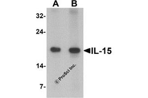 Western Blotting (WB) image for anti-Interleukin 15 (IL15) antibody (ABIN1077441) (IL-15 Antikörper)