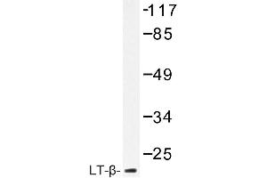 Image no. 1 for anti-Lymphotoxin-alpha (LTA) antibody (ABIN272216) (LTA Antikörper)