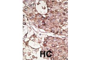 Immunohistochemistry (IHC) image for anti-CD90 (THY1) antibody (ABIN3001433) (CD90 Antikörper)