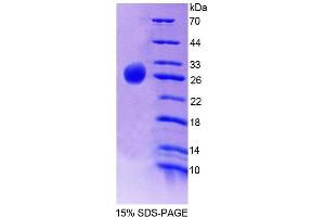 SDS-PAGE analysis of Human CSN1 Protein.