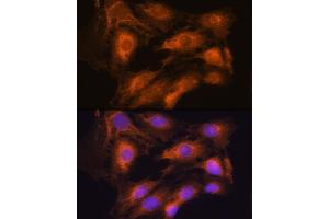Immunofluorescence analysis of C6 cells using  Rabbit pAb (ABIN7265658) at dilution of 1:100. (ARCN1 Antikörper  (AA 212-511))