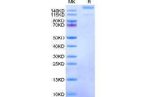 Human ITGA1&ITGB1 on Tris-Bis PAGE under reduced condition. (Integrin alpha A1 beta 1 (ITGA1 & ITGB1) Heterodimer (AA 29-1141) protein (His tag))
