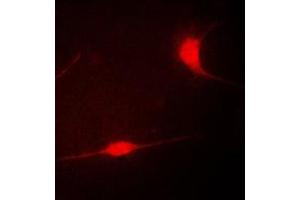Immunofluorescence (IF) image for anti-LIM Domain Kinase 1 (LIMK1) (Center) antibody (ABIN7296184)