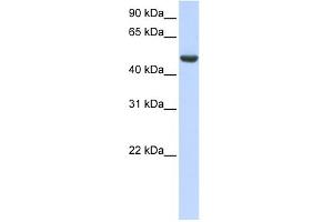 WB Suggested Anti-SPATA17 Antibody Titration: 0. (SPATA17 Antikörper  (C-Term))