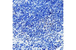 Immunohistochemistry of paraffin-embedded mouse spleen using P antibody  at dilution of 1:100 (40x lens). (PARP1 Antikörper)