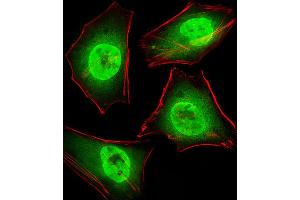 Fluorescent image of Hela cells stained with GTF2I Antibody . (GTF2I Antikörper  (C-Term))