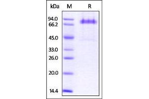 Human Dkk-1, Fc Tag on SDS-PAGE under reducing (R) condition. (DKK1 Protein (AA 32-266) (Fc Tag))