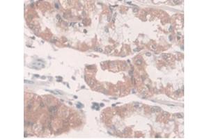 DAB staining on IHC-P Samples:Human Stomach Tissue (SLC40A1 Antikörper  (AA 127-321))