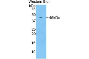Western blot analysis of the recombinant protein. (Lactoferrin Antikörper  (AA 550-707))