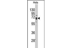 Western blot analysis of FZD1 polyclonal antibody  in HeLa cell line lysates (35 ug/lane). (FZD1 Antikörper  (Internal Region))