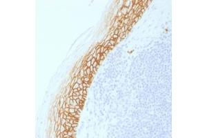 anti-CD44v9 antibody