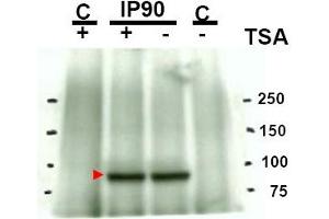 Image no. 1 for anti-Heat Shock Protein 90kDa alpha (Cytosolic), Class A Member 1 (HSP90AA1) (acLys294) antibody (ABIN401378) (HSP90AA1 Antikörper  (acLys294))