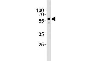 Western Blotting (WB) image for anti-Activin Receptor Type I (ACRV1) (AA 132-162) antibody (ABIN3029855)
