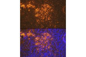 Immunofluorescence analysis of mouse spleen using CXCR5 Rabbit mAb (ABIN7266321) at dilution of 1:100 (40x lens). (CXCR5 Antikörper)