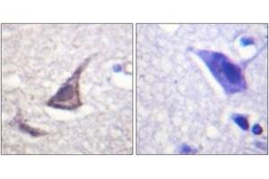 Immunohistochemistry analysis of paraffin-embedded human brain tissue, using C/EBP-epsilon (Ab-74) Antibody. (CEBPE Antikörper  (AA 40-89))
