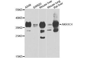 Western blot analysis of extracts of various cell lines, using AKR1C4 antibody. (AKR1C4 Antikörper  (AA 1-323))