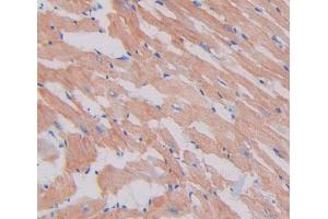Immunohistochemistry (IHC) image for anti-Myosin Heavy Chain 3, Skeletal Muscle, Embryonic (MYH3) (AA 1593-1848) antibody (ABIN1859926)