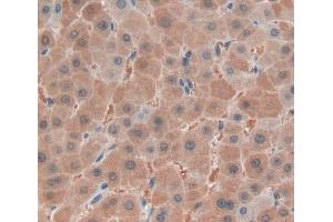 IHC-P analysis of liver tissue, with DAB staining. (FARS2 Antikörper  (AA 1-451))
