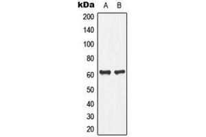 Western blot analysis of PLA2G4C expression in Jurkat (A), human pancreas (B) whole cell lysates. (PLA2G4C Antikörper  (Center))
