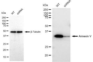 Western blotting analysis using Annexin V antibody (ABIN7797622). (Rekombinanter Annexin V Antikörper)