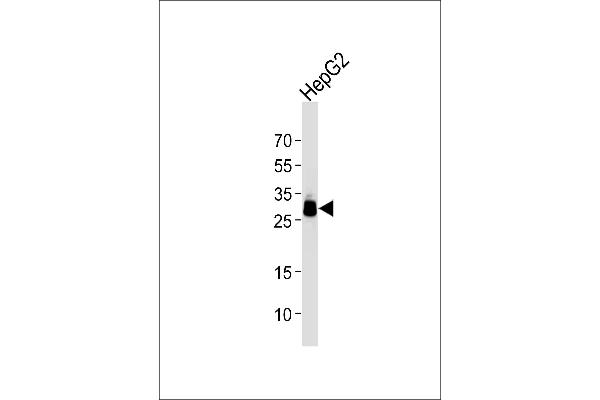 PPT1 anticorps  (AA 1-306)